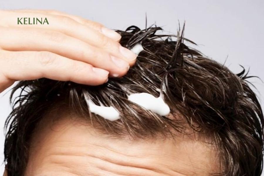Dùng keo, sáp vuốt tóc có thể gây bít tắc nang tóc